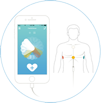 Grafische Darstellung der Anwendung von CardioSecur