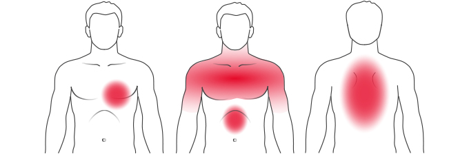 Illustration of the most typical symptoms of a heart attack