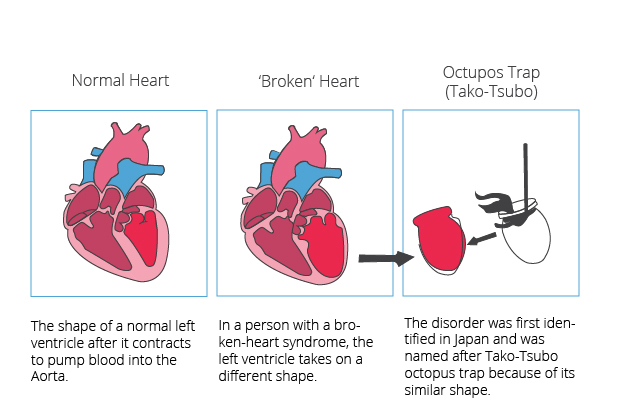 Heart with broken heart syndrome