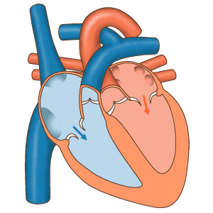 Extrasystoles occur because of a disturbance of the cardiac rhythm outside the sinus node. Illustration of the heart during the pumping action