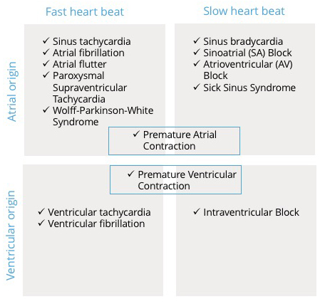 A table with common arrhythmias