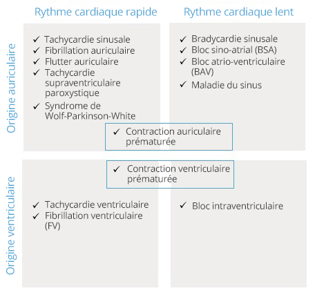 Tableau avec les arythmies les plus fréquentes.