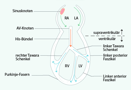 Abbildung des Leitungssystemes des Herzens