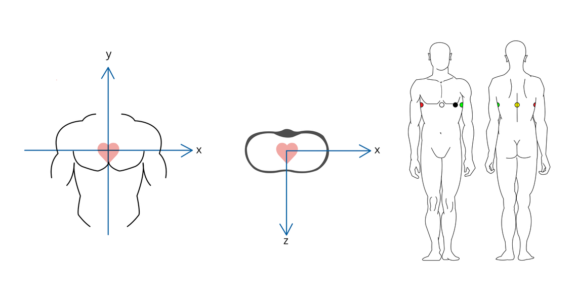 Darstellung der Raumachsen eines Vektor-EKGs nach Frank