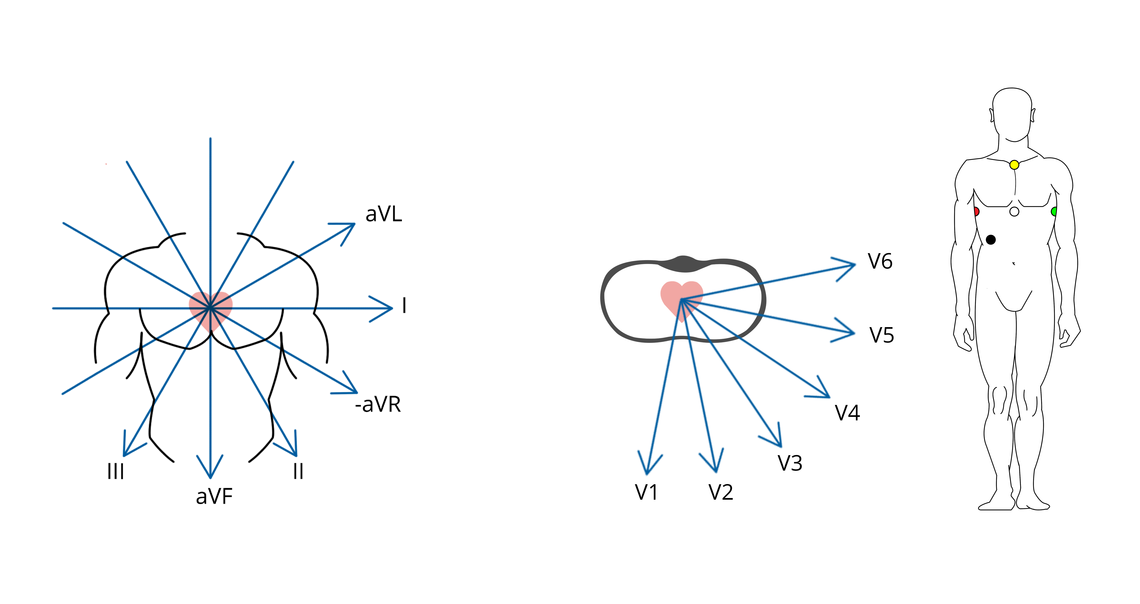Illustration des vecteurs d'un ECG à 12 dérivations enregistrés via les points de fixation spécifiques d'un ECG EASI