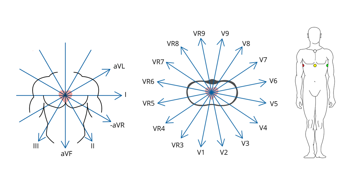 Illustration des vecteurs d'un ECG à 12 dérivations enregistrés via les points de fixation spécifiques d'un ECG CardioSecur