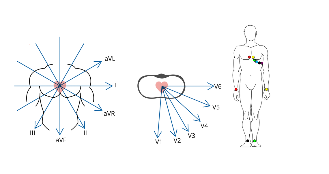 Darstellung räumlicher Vektoren eines 12-Kanal-EKGs mit den spezifizierten Anlagepunkten  