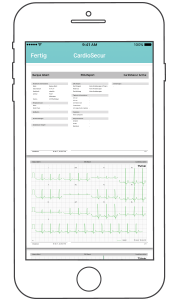 EKG Bericht