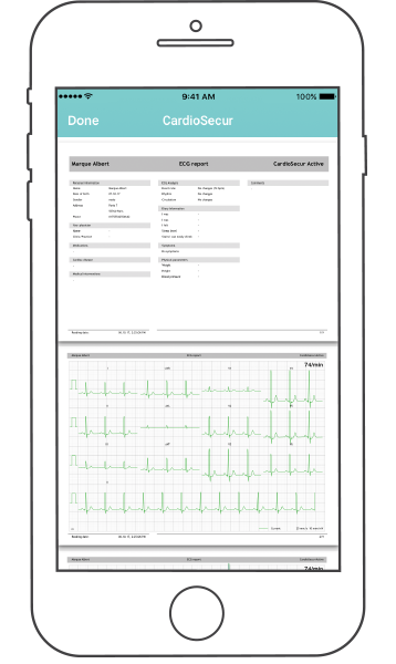 ECG report