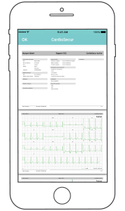 Rapport ECG