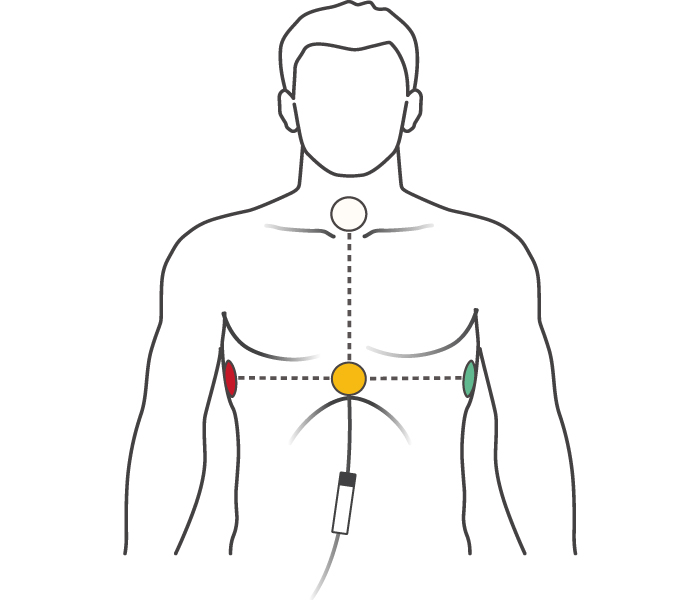 Image of position of electrodes on upper body