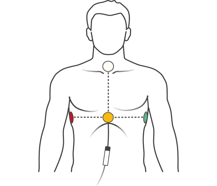 Illustration de la position de l'électrode sur le haut du corps