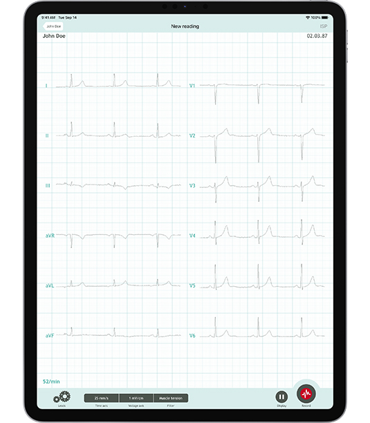 CardioSecur Pro app on iPad Pro 12.9" showing a 12-lead ECG reading.