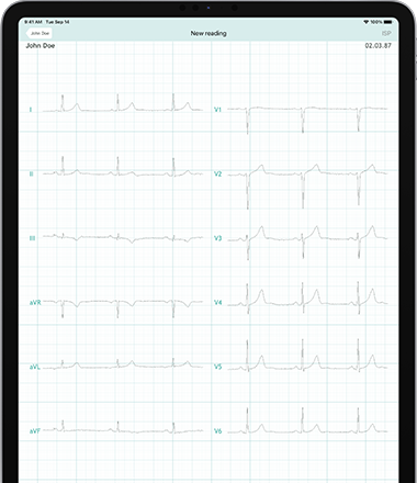 iPad Pro 12.9 pouces avec l'application CardioSecur Pro lors d'un enregistrement ECG.