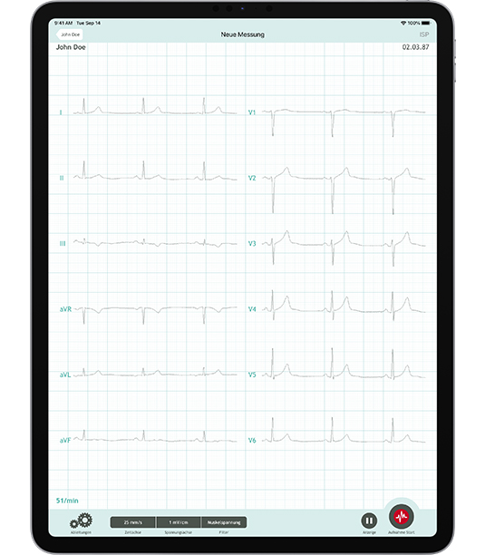 Die CardioSecur Pro App auf dem iPad Pro 12.9" zeigt ein 12-Kanal-EKG an.