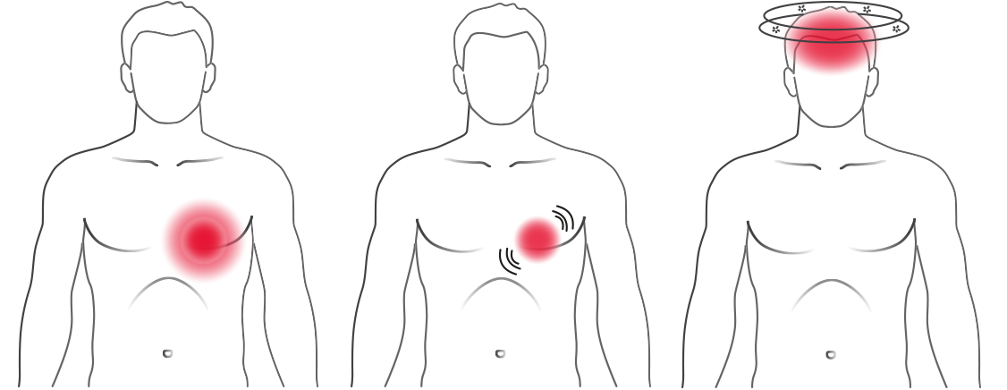 Illustration : Symptômes typiques des arythmies cardiaques