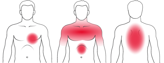 Depiction: Typical symptoms of heart problems