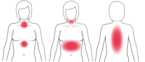 Depiction: Typical symptoms of heart problems