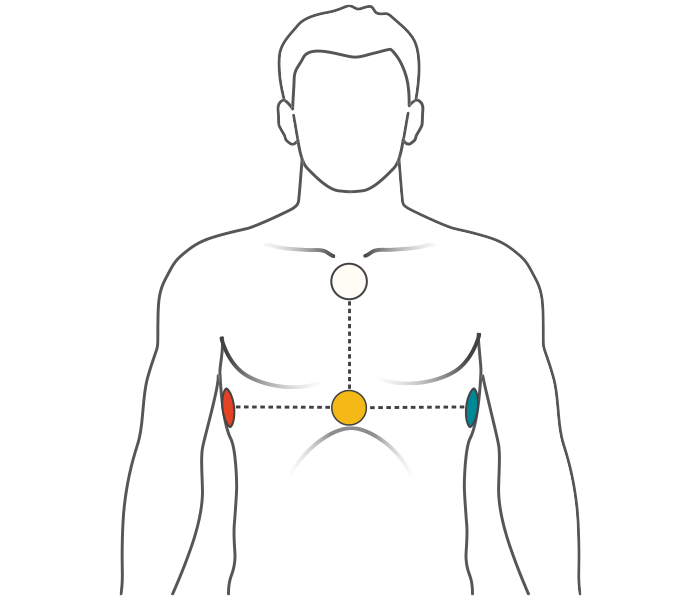 Illustration de la position de l'électrode sur le haut du corps