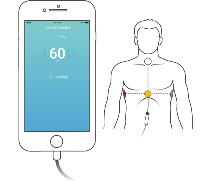 Illustration de l’enregistrement ECG dans l'application CardioSecur Active