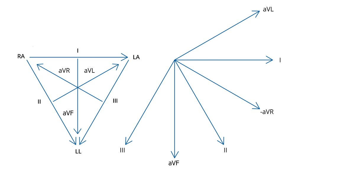 Représentation schématique des dérivations de Goldberger dans le Triangle d'Einthoven et dans le système Cabrera