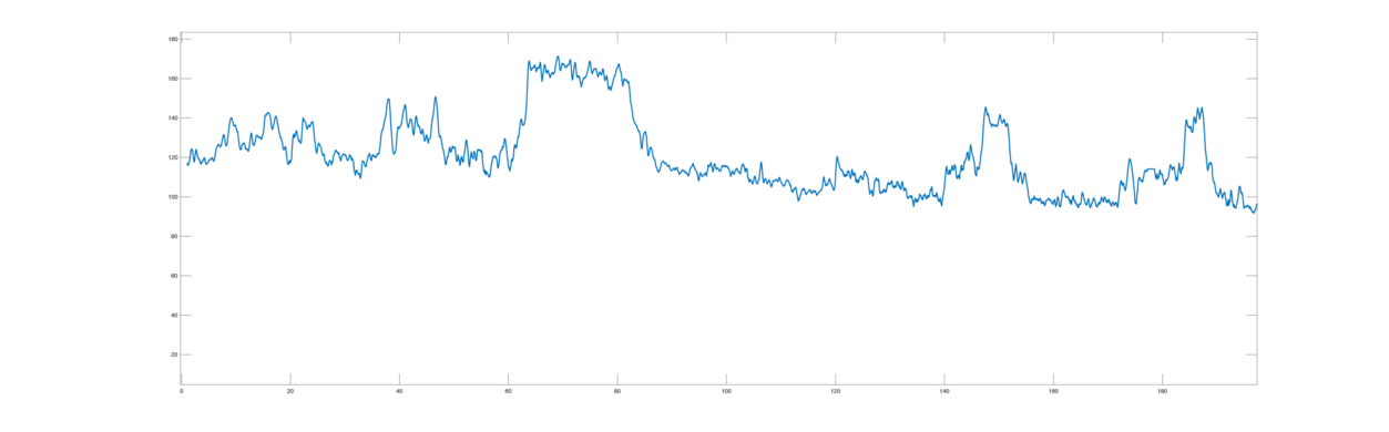 Illustration of ECG during car rally